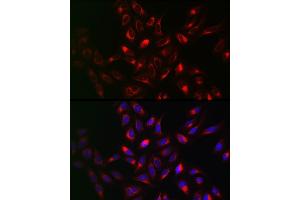 Immunofluorescence analysis of U2OS cells using VAPB Rabbit pAb (ABIN6132783, ABIN6150058, ABIN6150059 and ABIN6221003) at dilution of 1:100 (40x lens). (VAPB anticorps  (AA 10-222))