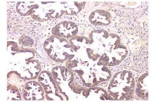 IHC analysis of WWOX using anti-WWOX antibody (ABIN6719627). (WWOX anticorps  (AA 1-245))