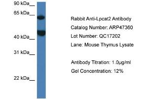 Western Blotting (WB) image for anti-Lysophosphatidylcholine Acyltransferase 2 (LPCAT2) (N-Term) antibody (ABIN2782922)