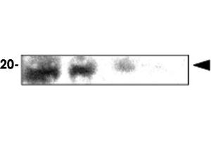 Immunoblot analysis of rat eye extracts were resolved by electrophoresis , transferred to PVDF membrane and probed with CRYAA monoclonal antibody , clone c9F2 (1 : 1000)  . (CRYAA anticorps  (AA 1-173))