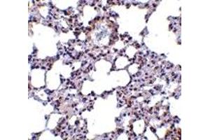 Immunohistochemistry (IHC) image for anti-Transient Receptor Potential Cation Channel, Subfamily C, Member 6 (TRPC6) (N-Term) antibody (ABIN1031645)