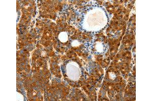 Immunohistochemistry (IHC) image for anti-Secretin Receptor (SCTR) antibody (ABIN1874706) (SCTR anticorps)