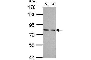 WB Image Sample (30 ug of whole cell lysate) A: JC B: BCL-1 7.