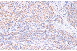 Immunohistochemistry of paraffin-embedded Rat ovary using COX5A Polyclonal Antibody at dilution of 1:100 (40x lens).