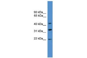 WB Suggested Anti-ARFIP1 Antibody Titration: 0. (ARFIP1 anticorps  (C-Term))
