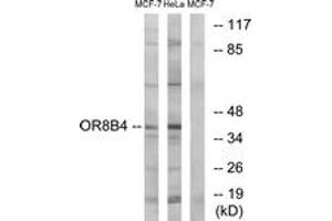 Western Blotting (WB) image for anti-Olfactory Receptor, Family 8, Subfamily B, Member 4 (OR8B4) (AA 260-309) antibody (ABIN2891145) (OR8B4 anticorps  (AA 260-309))