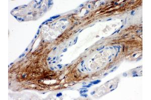 Immunohistochemistry (Paraffin-embedded Sections) (IHC (p)) image for anti-Tenascin XB (TNXB) (AA 3309-3337), (C-Term) antibody (ABIN3043715) (TNXB anticorps  (C-Term))