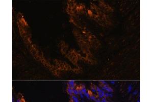 Immunofluorescence analysis of Mouse bronchus cells using KRT7 Polyclonal Antibody at dilution of 1:100. (Cytokeratin 7 anticorps)