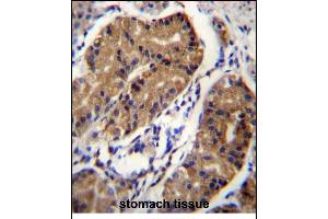 anti-Deleted in Colorectal Carcinoma (DCC) (AA 643-670) antibody