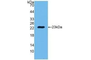 Detection of Recombinant PGLYRP1, Human using Polyclonal Antibody to Peptidoglycan Recognition Protein 1 (PGLYRP1)
