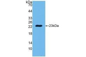 Detection of Recombinant PGLYRP1, Human using Polyclonal Antibody to Peptidoglycan Recognition Protein 1 (PGLYRP1) (PGLYRP1 anticorps  (AA 22-196))