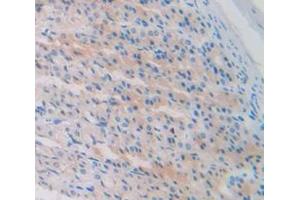 IHC-P analysis of Rat Tissue, with DAB staining. (CKB anticorps  (AA 11-367))