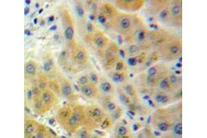 Used in DAB staining on fromalin fixed paraffin-embedded Liver tissue (ADH1 anticorps  (AA 25-228))