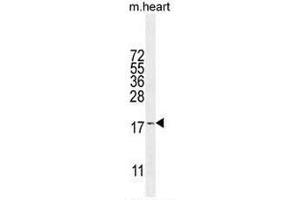 SNR27 Antibody (Center) western blot analysis in mouse heart tissue lysates (35µg/lane). (SNRNP27 anticorps  (Middle Region))