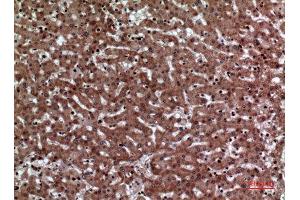 Immunohistochemistry (IHC) analysis of paraffin-embedded Human Liver, antibody was diluted at 1:100.