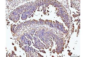 IHC analysis of DUSP6 using anti-DUSP6 antibody (ABIN7599332). (DUSP6 anticorps  (AA 1-381))