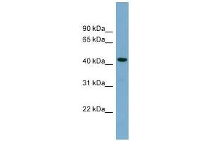 WB Suggested Anti-CDCA7L Antibody Titration: 0. (CDCA7L anticorps  (Middle Region))