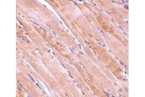 Immunohistochemistry of EMD in human skeletal muscle tissue with EMD polyclonal antibody  at 2. (Emerin anticorps  (N-Term))