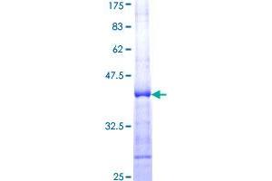 Image no. 1 for PR Domain Containing 2, with ZNF Domain (PRDM2) (AA 1606-1705) protein (GST tag) (ABIN1316143)