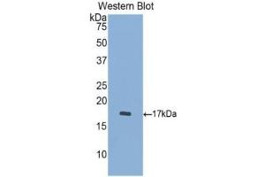 WB of Protein Standard: different control antibodies against Highly purified E. (Cathepsin D Kit ELISA)
