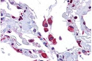 Human Lung: Formalin-Fixed, Paraffin-Embedded (FFPE) (EIF2AK1 anticorps  (AA 108-157))