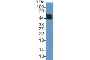Detection of a1AGP in Human Lung lysate using Polyclonal Antibody to Alpha-1-Acid Glycoprotein (a1AGP)