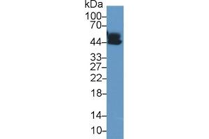 Detection of a1AGP in Human Lung lysate using Polyclonal Antibody to Alpha-1-Acid Glycoprotein (a1AGP) (ORM1 anticorps  (AA 19-201))