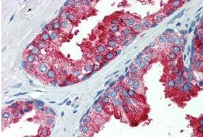 Human Prostate (formalin-fixed, paraffin-embedded) stained with YAP1 antibody ABIN462247 followed by biotinylated goat anti-rabbit IgG secondary antibody ABIN481713, alkaline phosphatase-streptavidin and chromogen.
