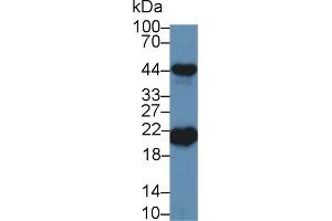 Detection of FTH in Porcine Cerebrum lysate using Polyclonal Antibody to Ferritin, Heavy Polypeptide (FTH)