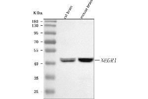 Western blot analysis of NEGR1 using anti-NEGR1 antibody (ABIN7601469).
