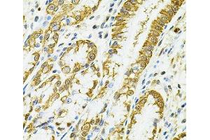 Immunohistochemistry of paraffin-embedded Human esophagus using HLA-DQA1 Polyclonal Antibody at dilution of 1:100 (40x lens).
