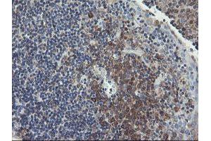 Image no. 17 for anti-Ubiquitin-Conjugating Enzyme E2, J1, U (UBE2J1) antibody (ABIN1501638)