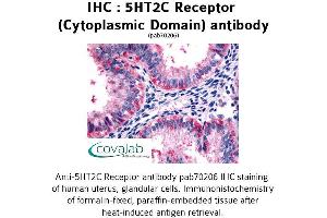 Image no. 1 for anti-5-Hydroxytryptamine (serotonin) Receptor 2C (HTR2C) (3rd Cytoplasmic Domain) antibody (ABIN1731366) (HTR2C anticorps  (3rd Cytoplasmic Domain))
