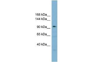 WB Suggested Anti-SART3 Antibody Titration:  0. (SART3 anticorps  (Middle Region))