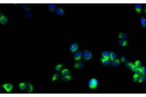 Immunofluorescence staining of PC-3 cells with ABIN7171386 at 1:53, counter-stained with DAPI.