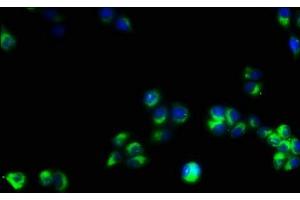 Immunofluorescence staining of PC-3 cells with ABIN7171386 at 1:53, counter-stained with DAPI. (CD3 epsilon anticorps  (AA 23-207))