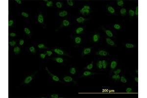 Immunofluorescence of monoclonal antibody to SMAD5 on HeLa cell. (SMAD5 anticorps  (AA 105-182))