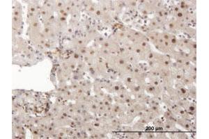 Immunoperoxidase of monoclonal antibody to PRKDC on formalin-fixed paraffin-embedded human liver.