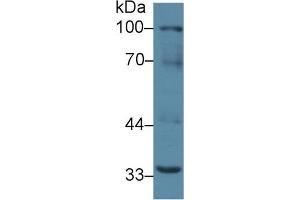 Western blot analysis of Mouse Liver lysate, using Mouse RANk Antibody (2 µg/ml) and HRP-conjugated Goat Anti-Rabbit antibody ( (TNFRSF11A anticorps  (AA 359-542))