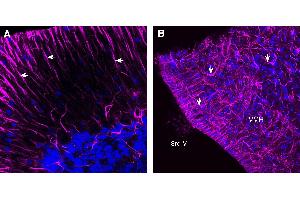 Expression of GFAP in rat cerebellum and hypothalamus. (GFAP anticorps  (Intracellular) (Atto 647N))