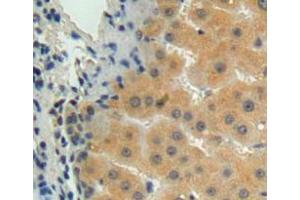 Used in DAB staining on fromalin fixed paraffin-embedded liver tissue (MMP15 anticorps  (AA 280-497))