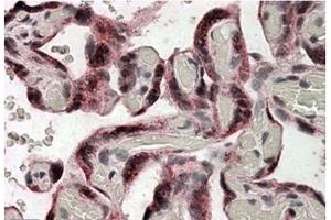Image no. 1 for anti-Iduronate 2-Sulfatase (IDS) (Internal Region) antibody (ABIN375037) (IDS anticorps  (Internal Region))