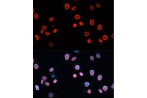 Immunofluorescence analysis of HeLa cells using CDKN1A/p21CIP1 antibody (ABIN3022005, ABIN3022006, ABIN3022007 and ABIN6218565) at dilution of 1:100. (p21 anticorps  (AA 43-142))