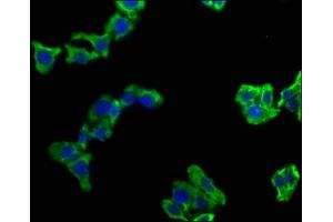 Immunofluorescence staining of HepG2 cells with ABIN7139751 at 1:100, counter-stained with DAPI. (CAMK2N1 anticorps  (AA 9-27))