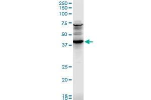 CADM1 polyclonal antibody (A01), Lot # UOZ1060607QCS1. (CADM1 anticorps  (AA 151-250))