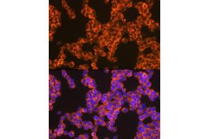 Immunofluorescence analysis of Jurkat cells using Oncostatin M Rabbit mAb (ABIN7269099) at dilution of 1:100 (40x lens).