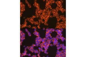 Immunofluorescence analysis of Jurkat cells using Oncostatin M Rabbit mAb (ABIN7269099) at dilution of 1:100 (40x lens). (Oncostatin M anticorps)