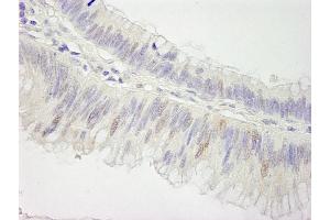 Immunohistochemistry (IHC) image for anti-Cullin 3 (CUL3) (AA 650-700) antibody (ABIN7448504)