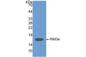 Detection of Recombinant HPA, Mouse using Polyclonal Antibody to Heparanase (HPSE) (HPSE anticorps  (AA 280-412))