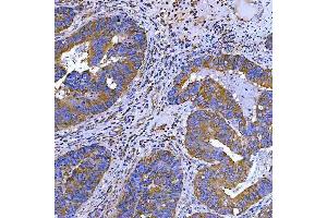 IHC analysis of SWAP70 using anti-SWAP70 antibody (ABIN7600201).